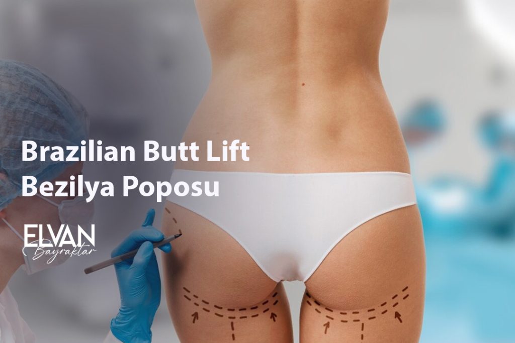 Brazilian Butt Lift- Bezilya Poposu