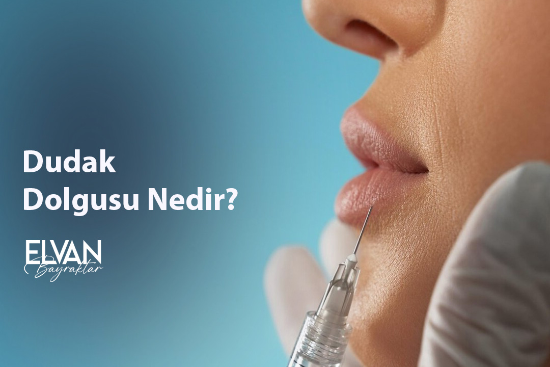 Dudak Dolgusu Nedir?