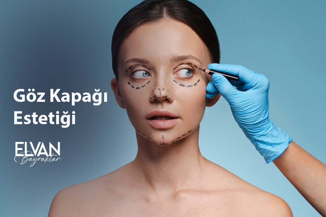 Göz Kapağı Estetiği