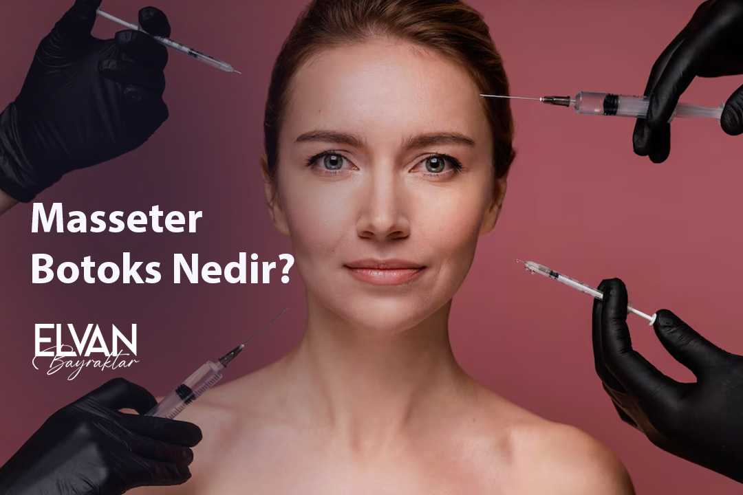 Masseter Botoks Nedir?