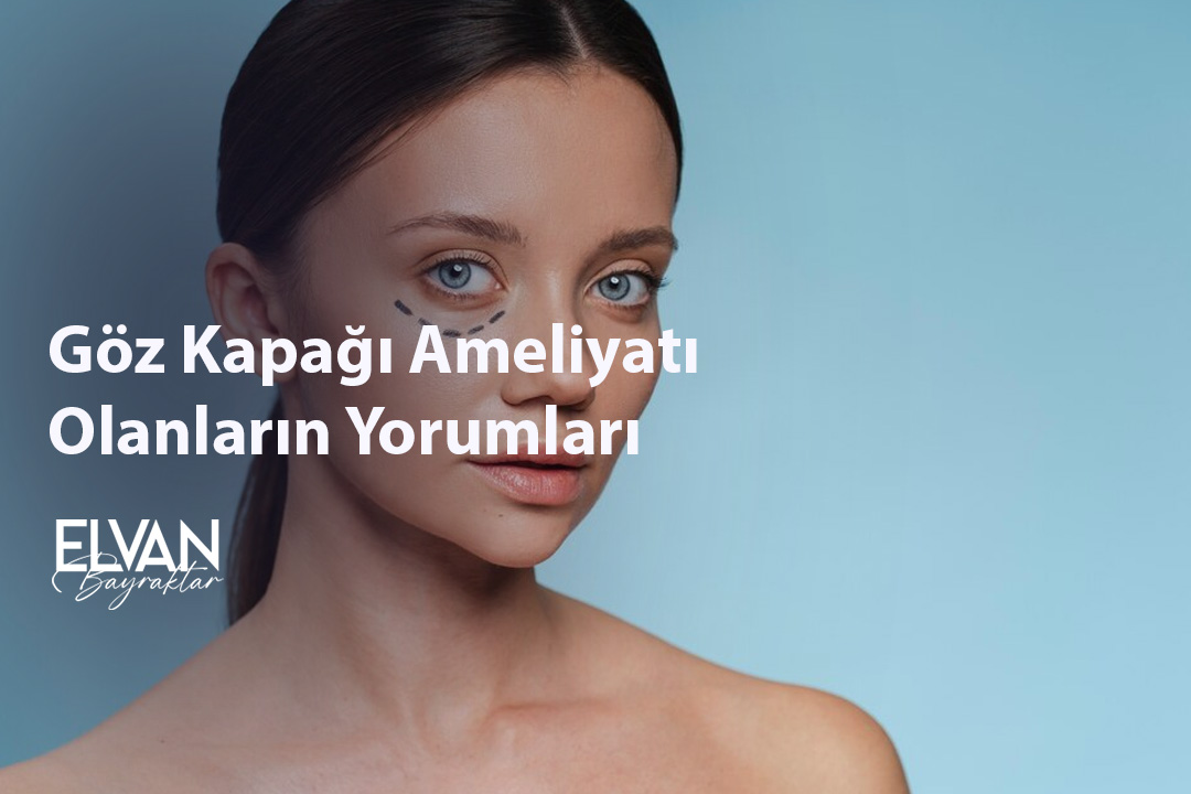 Göz Kapağı Ameliyatı Olanların Yorumları