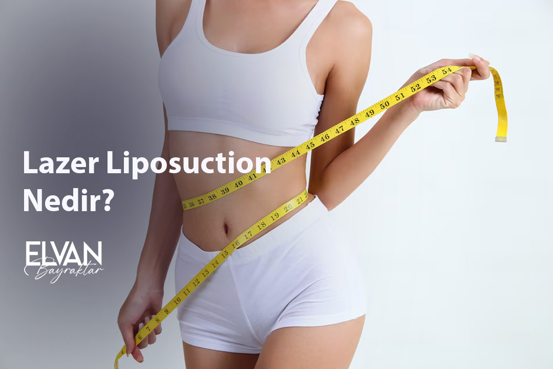 Lazer Liposuction Nedir?