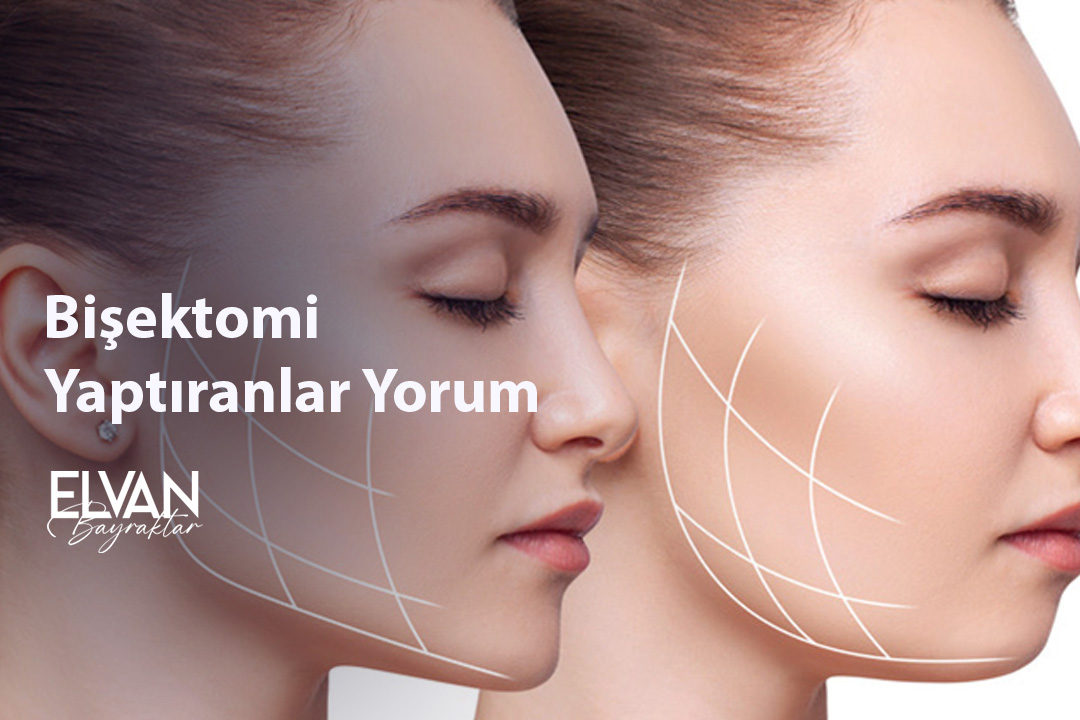 Bişektomi Yaptıranlar Yorum​