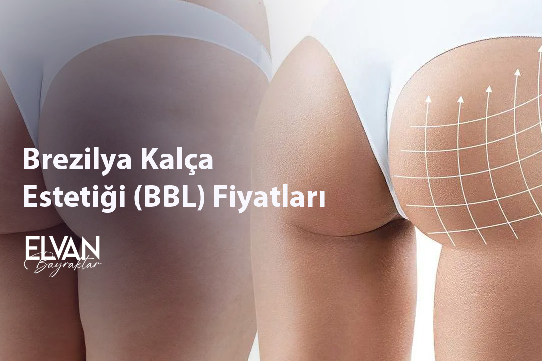 Brezilya Kalça Estetiği (BBL) Fiyatları