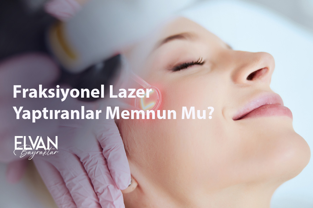 Fraksiyonel Lazer Yaptıranlar Memnun Mu?