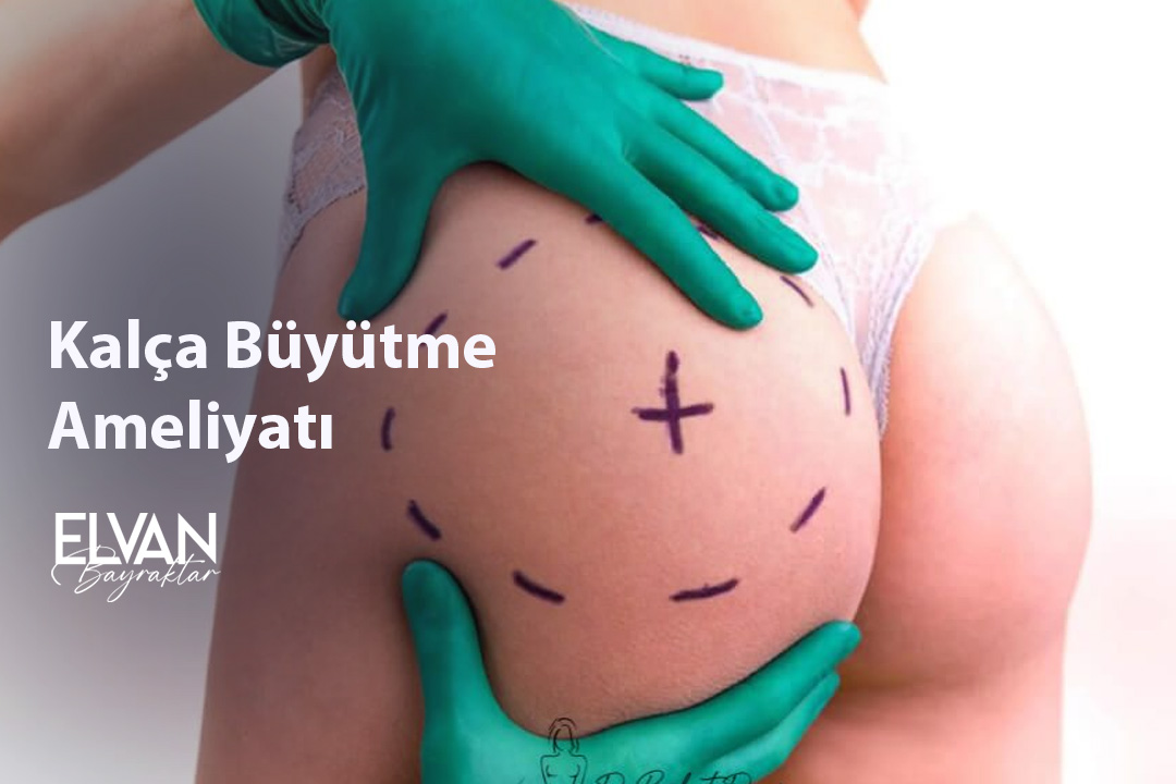 Kalça Büyütme Ameliyatı