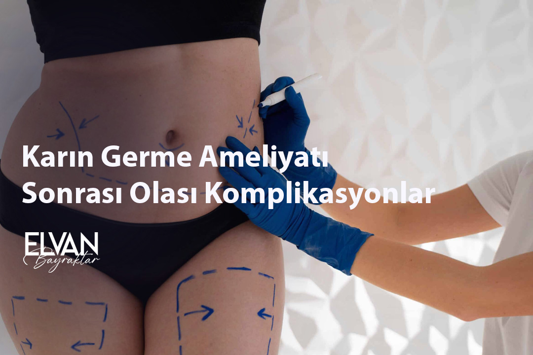 Karın Germe Ameliyatı Sonrası Olası Komplikasyonlar