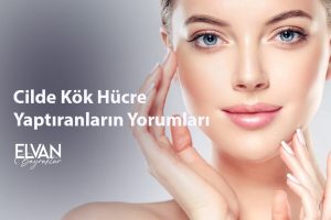 Cilde Kök Hücre Yaptıranların Yorumları