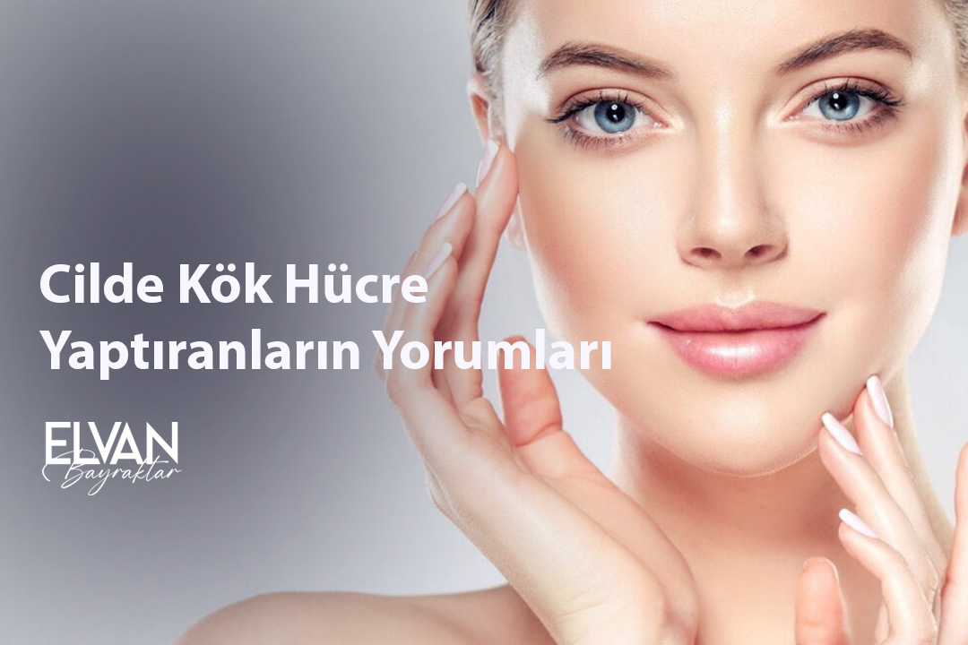 Cilde Kök Hücre Yaptıranların Yorumları