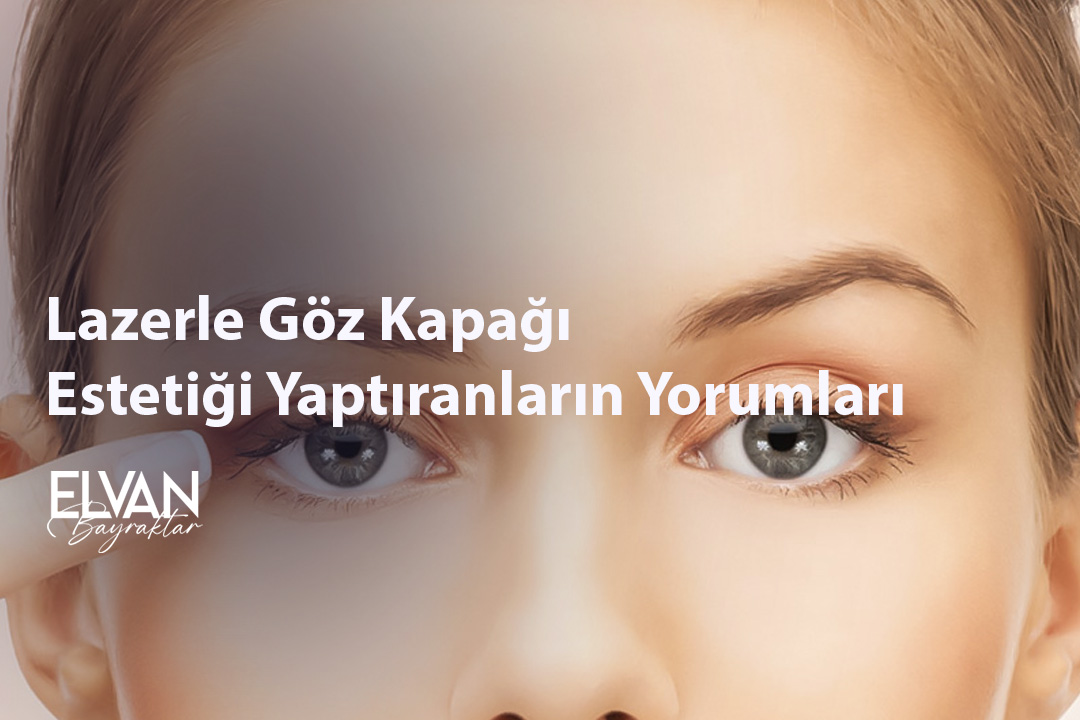 Lazerle Göz Kapağı Estetiği Yaptıranların Yorumları