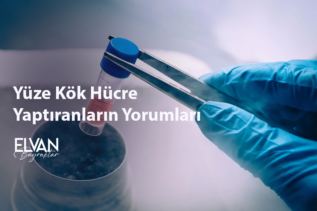 Yüze Kök Hücre Yaptıranların Yorumları