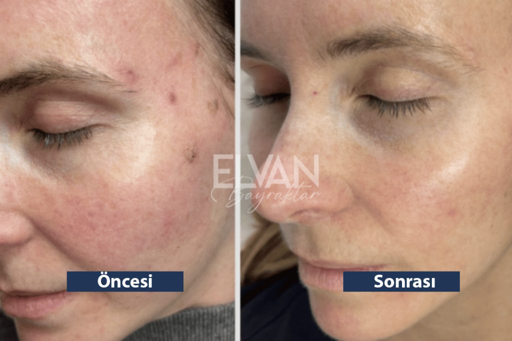 Uygulama Öncesi ve Sonrası Değişimler (Before & After)