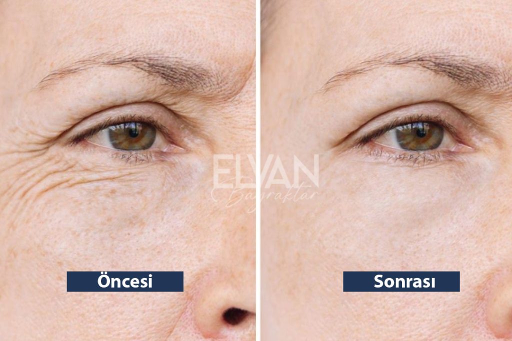 Uygulama Öncesi ve Sonrası Değişimler (Before & After)